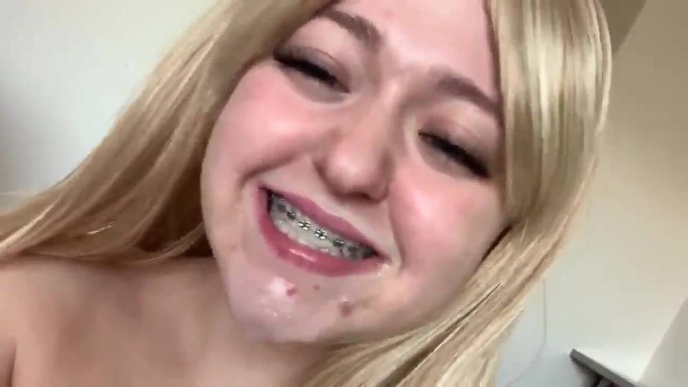 Braces full of cum - xh.video