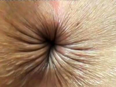 close up butthole winking - icpvid.com